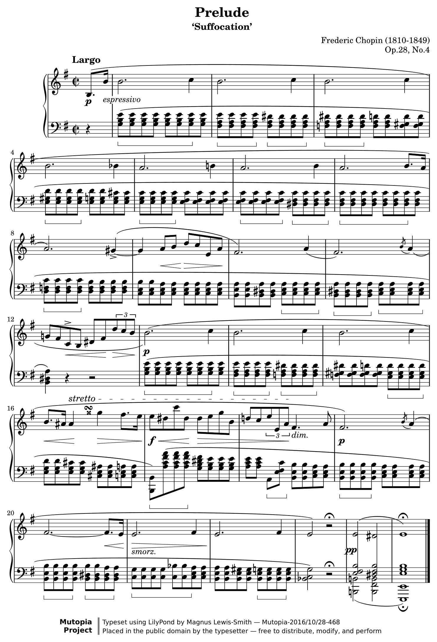 Preludio op. 28 n. 4 – 1